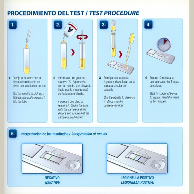 TEST RAPIDO PARA LA DETECCION DE LEGIONELLA EN ORINA My CMS